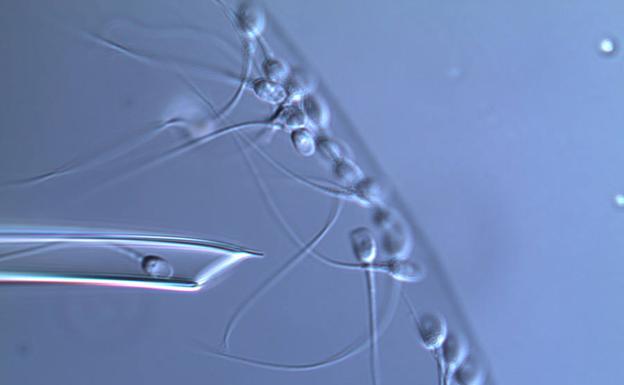 Espermatozoides vistos a gran aumento.